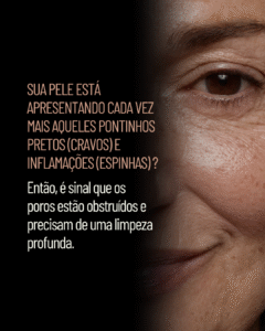 19 Posts para lembrar da limpeza de pele profissional