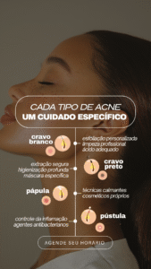 diferentes tipos de acne e seus tratamentos