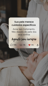 diferentes tipos de acne e seus tratamentos