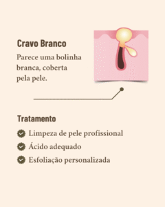 diferentes tipos de acne e seus tratamentos