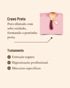 diferentes tipos de acne e seus tratamentos
