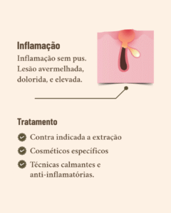diferentes tipos de acne e seus tratamentos