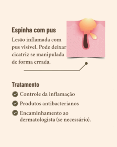 diferentes tipos de acne e seus tratamentos