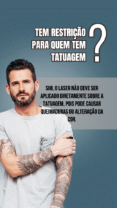 Depilação a laser masculina
