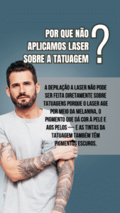 depilação a laser masculina