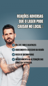 depilação a laser masculina