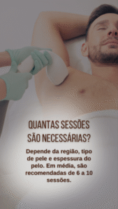 depilação a laser masculina