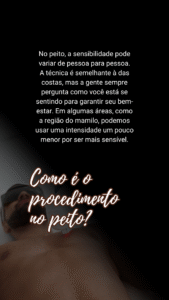 depilação a laser masculina