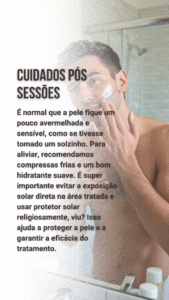 depilação a laser masculina