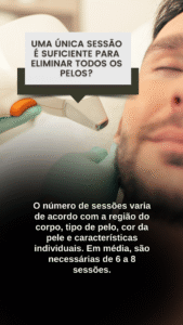 depilação a laser masculina
