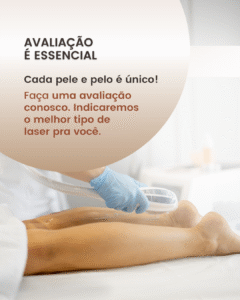Mitos e verdades sobre depilação a laser