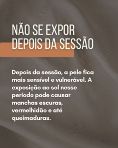 Mitos e verdades sobre depilação a laser