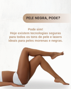 Mitos e verdades sobre depilação a laser