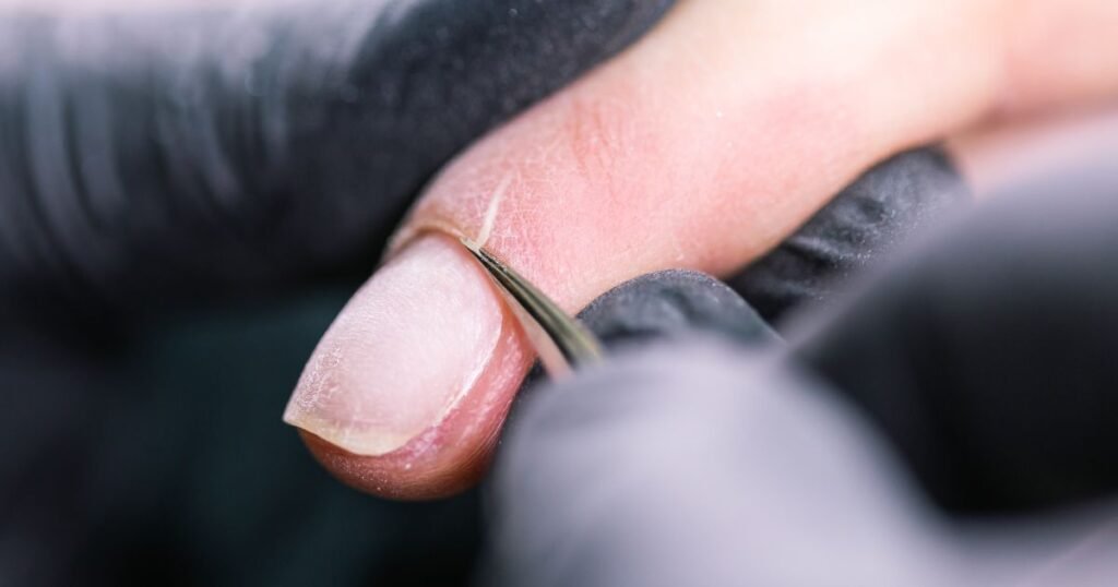 remover ou não cutículas