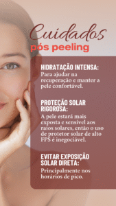 peeling para mulheres 40
