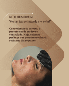 peeling para mulheres 40