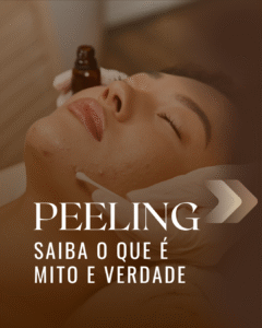 peeling para mulheres 40